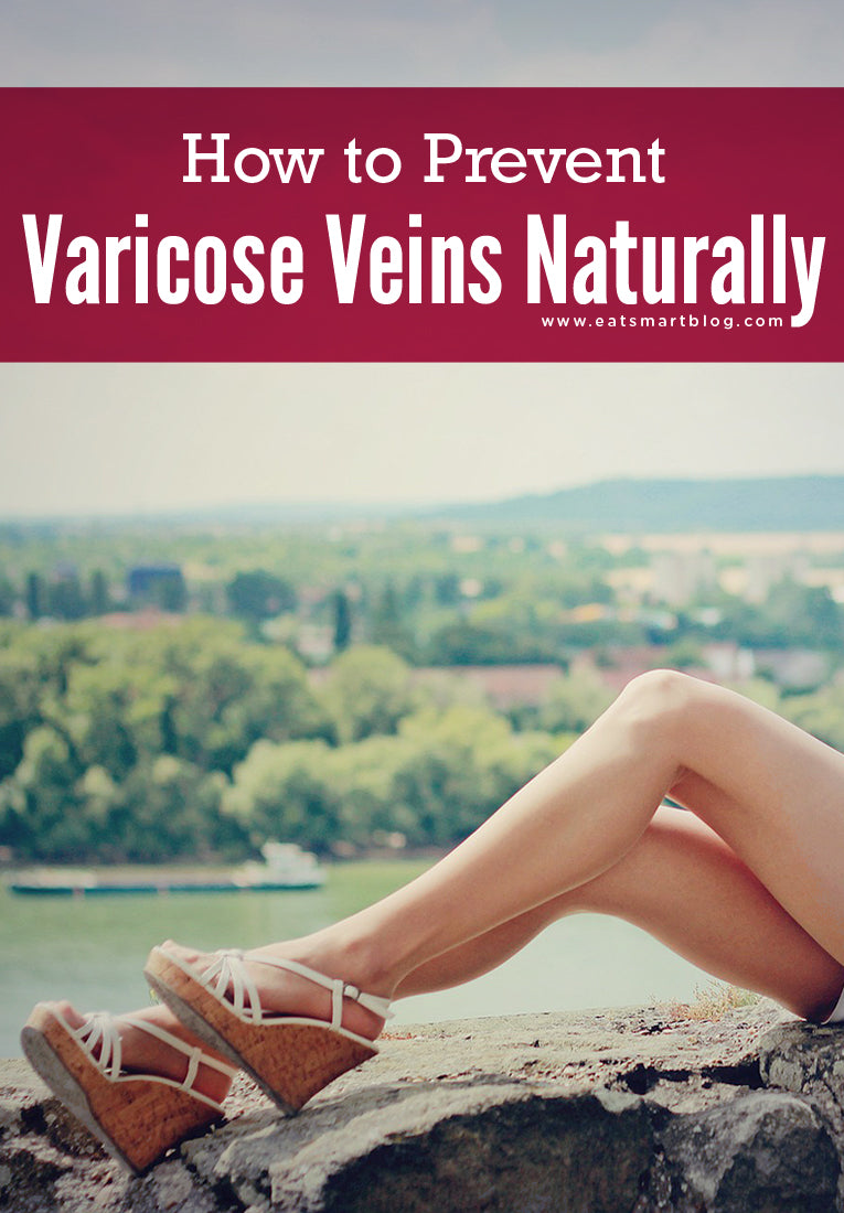 How to Prevent Varicose Veins Naturally – Eat Smart